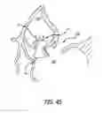 Fig. 25 - Stentless support structure