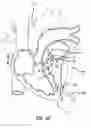 Fig. 26 - Stentless support structure