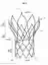 Fig. 03 - Flexible catheters and methods of forming same