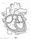 Fig. 04 - Flexible catheters and methods of forming same