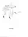 Fig. 20 - Systems and methods for affixing a prosthesis to tissue