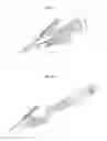 Fig. 29 - Systems and methods for affixing a prosthesis to tissue