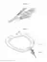 Fig. 32 - Systems and methods for affixing a prosthesis to tissue