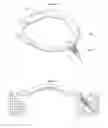 Fig. 33 - Systems and methods for affixing a prosthesis to tissue