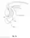 Fig. 03 - Medical system for annuloplasty