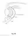 Fig. 04 - Medical system for annuloplasty