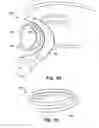 Fig. 06 - Medical system for annuloplasty