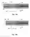 Fig. 18 - Medical system for annuloplasty