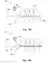 Fig. 19 - Medical system for annuloplasty