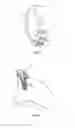 Fig. 04 - Glenoid extension block