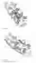 Fig. 12 - Orthopedic stabilization devices and methods for installation thereof