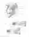 Fig. 02 - Expandable intervertebral implant