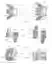 Fig. 09 - Expandable intervertebral implant