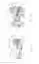 Fig. 14 - Expandable intervertebral implant