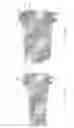 Fig. 16 - Expandable intervertebral implant