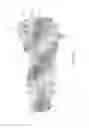 Fig. 17 - Expandable intervertebral implant