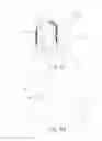 Fig. 10 - EXPANDABLE INTERBODY IMPLANT