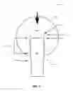 Fig. 12 - Prosthesis installation systems and methods