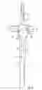 Fig. 07 - System for treating proximal humeral fractures and method of using the same