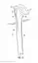 Fig. 14 - System for treating proximal humeral fractures and method of using the same