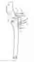 Fig. 18 - System for treating proximal humeral fractures and method of using the same
