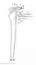 Fig. 23 - System for treating proximal humeral fractures and method of using the same