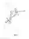 Fig. 27 - System for treating proximal humeral fractures and method of using the same