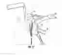 Fig. 33 - System for treating proximal humeral fractures and method of using the same