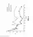 Fig. 03 - Stents having controlled elution