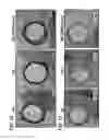 Fig. 13 - Stents having controlled elution