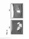 Fig. 14 - Stents having controlled elution