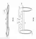 Fig. 03 - VASCULAR STENTING FOR ANEURYSMS