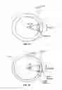 Fig. 20 - VASCULAR STENTING FOR ANEURYSMS