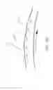 Fig. 26 - VASCULAR STENTING FOR ANEURYSMS
