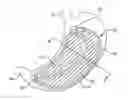 Fig. 01 - DEVICES AND SYSTEMS FOR GASTRIC VOLUME CONTROL
