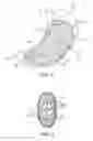 Fig. 02 - DEVICES AND SYSTEMS FOR GASTRIC VOLUME CONTROL
