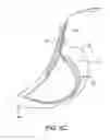 Fig. 05 - DEVICES AND SYSTEMS FOR GASTRIC VOLUME CONTROL
