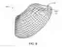 Fig. 08 - DEVICES AND SYSTEMS FOR GASTRIC VOLUME CONTROL