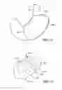 Fig. 11 - DEVICES AND SYSTEMS FOR GASTRIC VOLUME CONTROL
