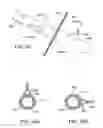 Fig. 15 - DEVICES AND SYSTEMS FOR GASTRIC VOLUME CONTROL