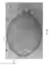 Fig. 04 - Intragastric device for treating obesity