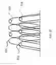 Fig. 08 - Intragastric device for treating obesity