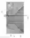 Fig. 10 - Intragastric device for treating obesity