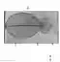 Fig. 25 - Intragastric device for treating obesity