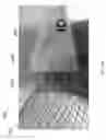 Fig. 38 - Intragastric device for treating obesity