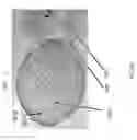 Fig. 41 - Intragastric device for treating obesity