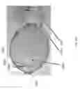 Fig. 42 - Intragastric device for treating obesity