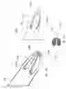 Fig. 46 - Intragastric device for treating obesity