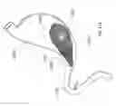 Fig. 53 - Intragastric device for treating obesity
