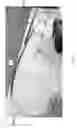 Fig. 75 - Intragastric device for treating obesity